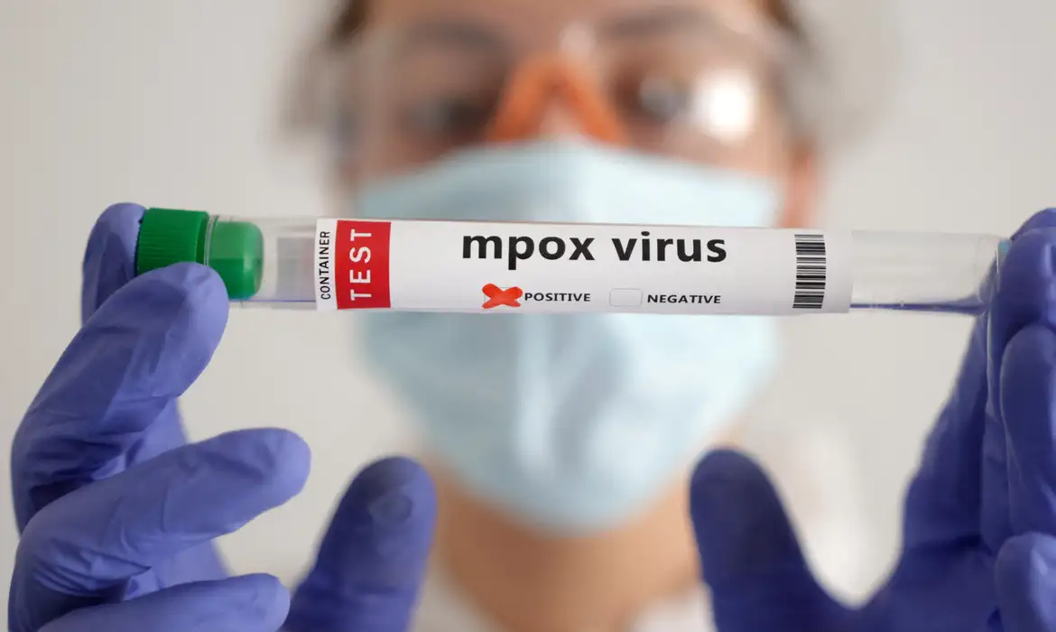 Mpox soma quase 50 mil casos em 28 países africanos, diz OMS - Imagem do artigo original