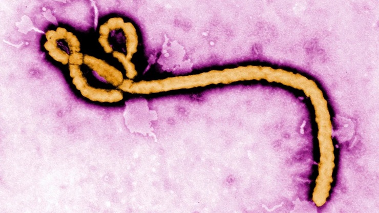 suspeita de ebola leva paciente a ser internado em s o paulo 20260530